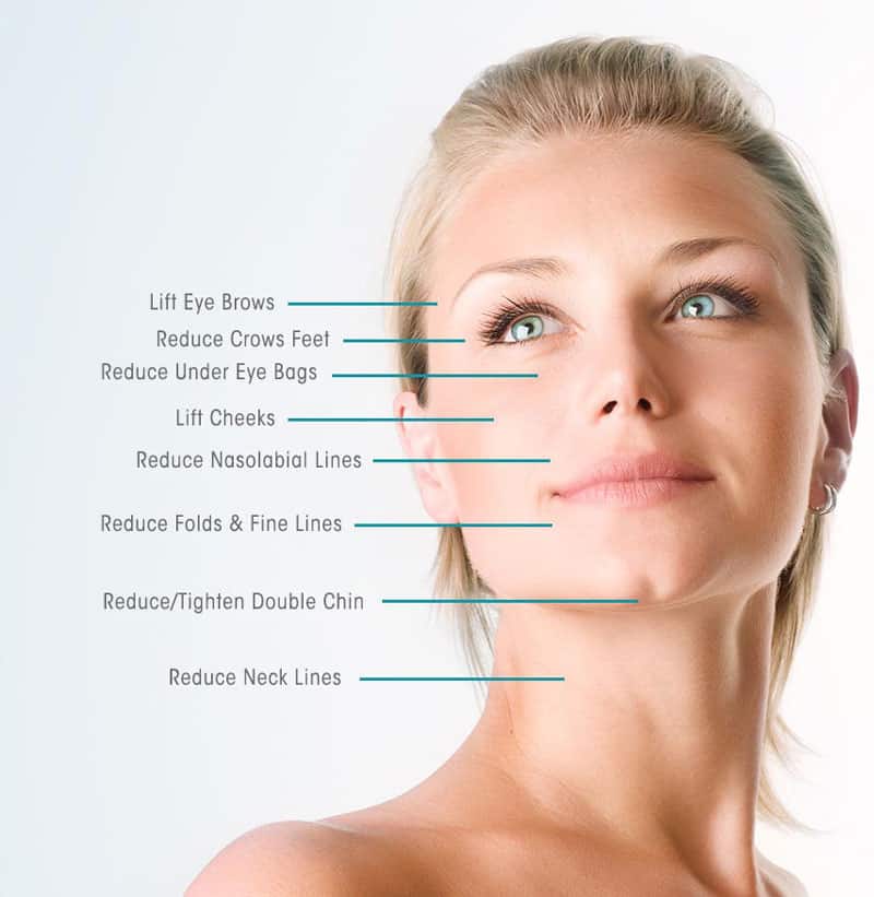 pdo-thread-lift-is the best at tighening skin